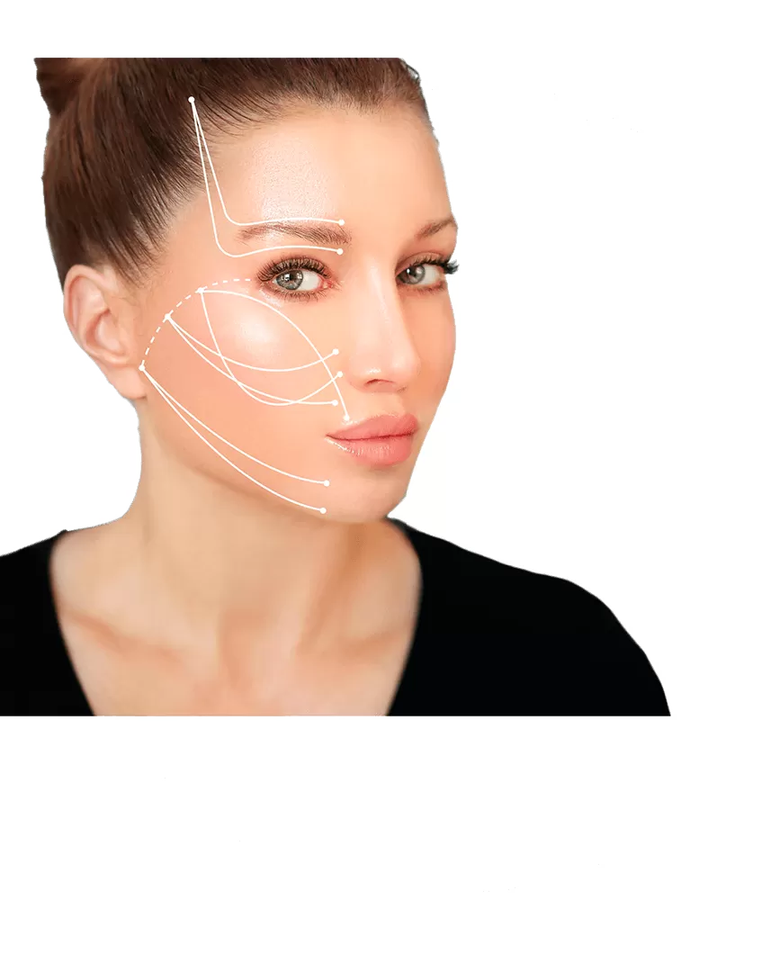 Spectra Laser
