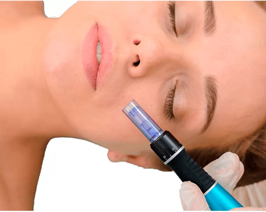 Microneedling