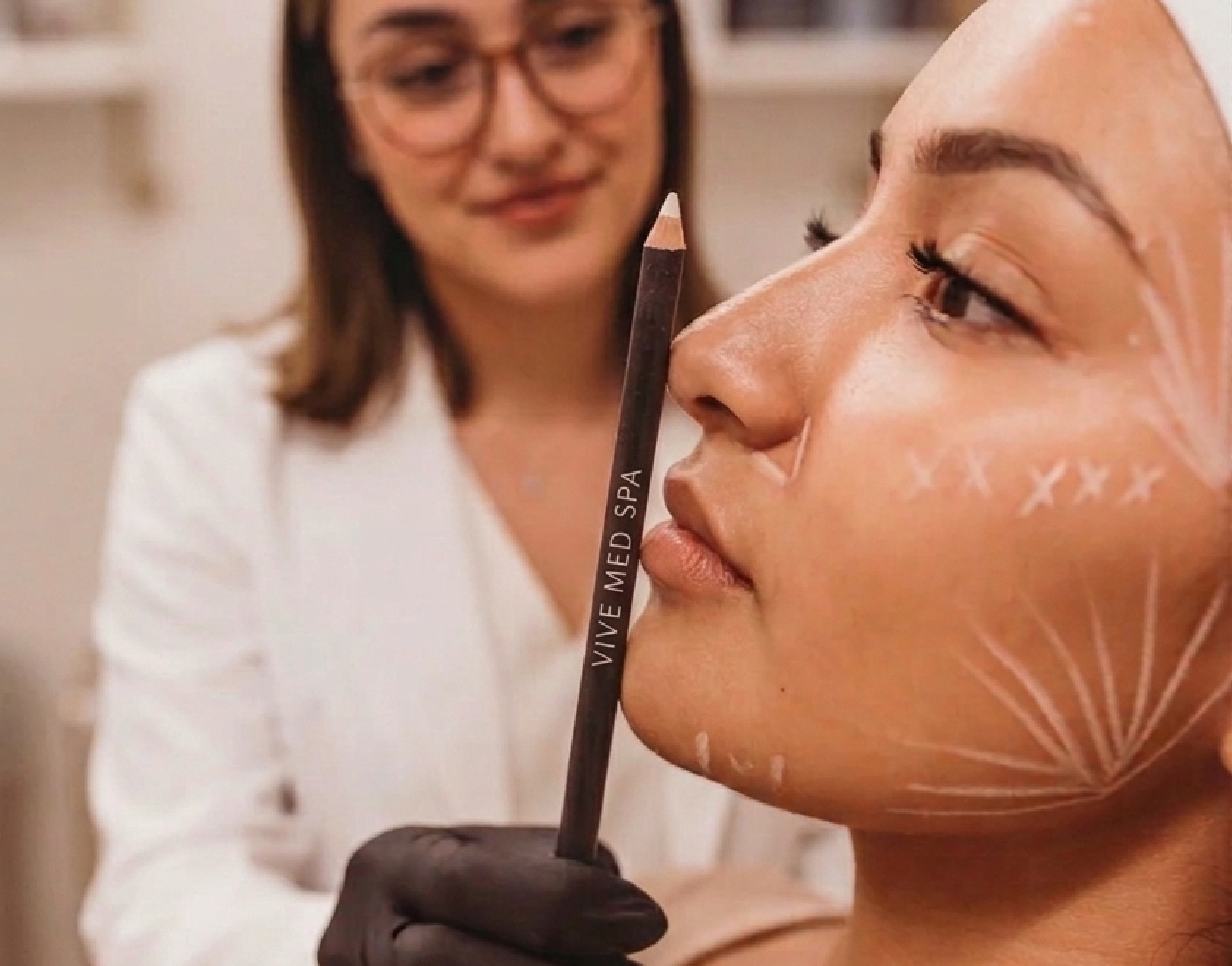 Chin augmentation Tijuana - Non-surgical chin enhancement Vive Med Spa