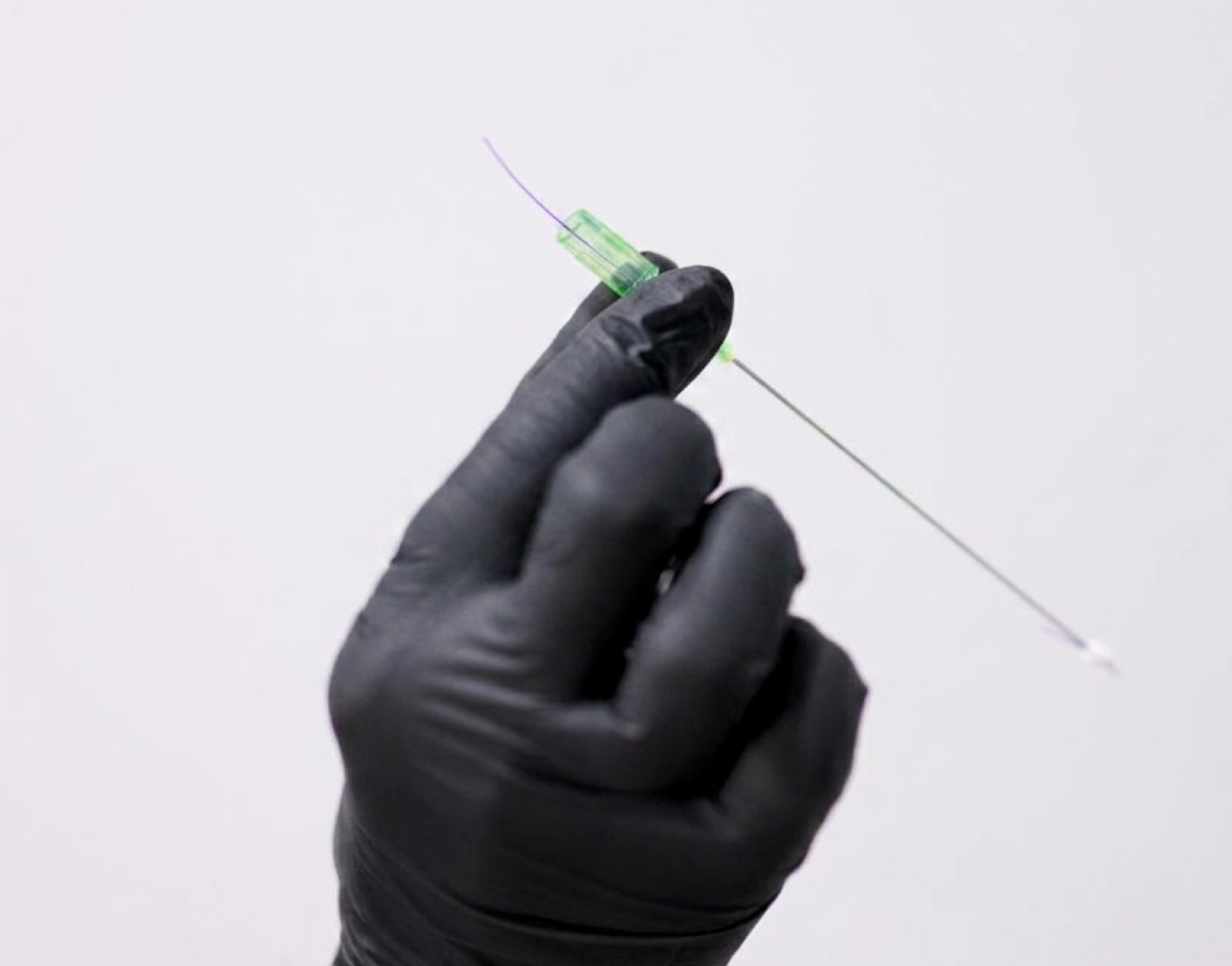PDO Threads treatment at Vive Medical Spa Tijuana