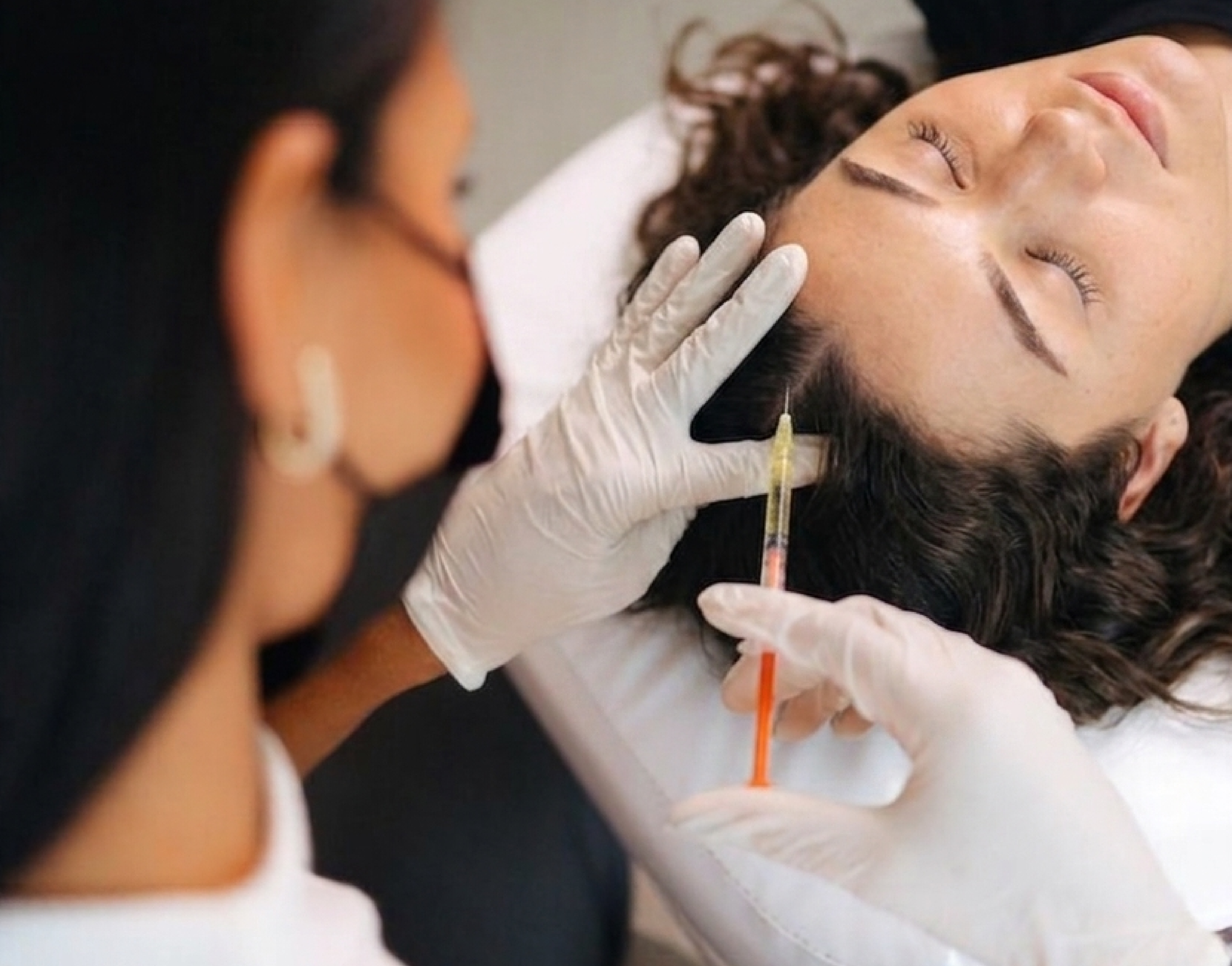 PRP Therapy at Vive Medical Spa Tijuana