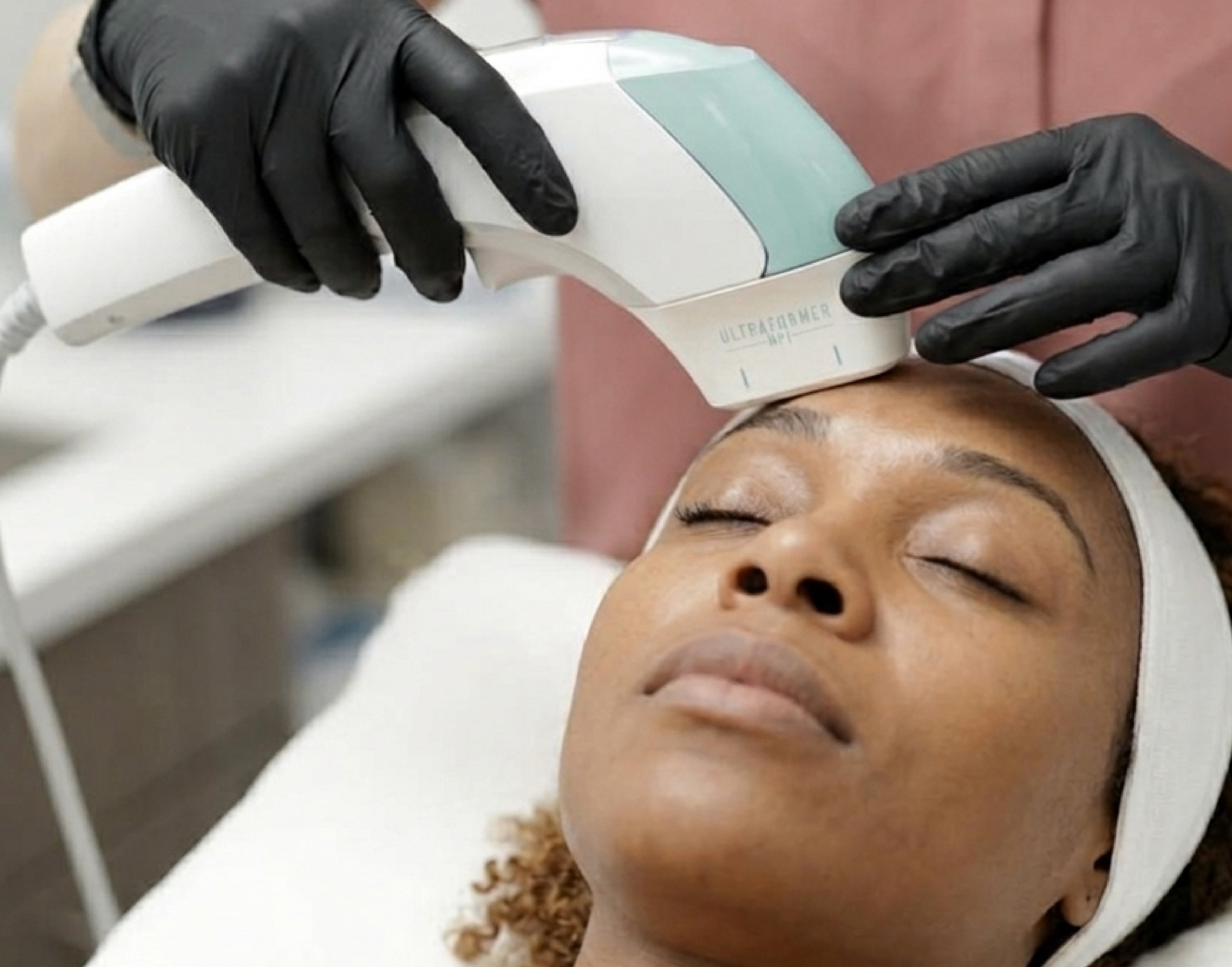 Ultraformer MPT treatment in Tijuana, Mexico - Next-generation non-surgical lifting at Vive Med Spa