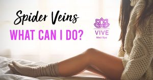 Read more about the article Get rid of spider veins in Tijuana