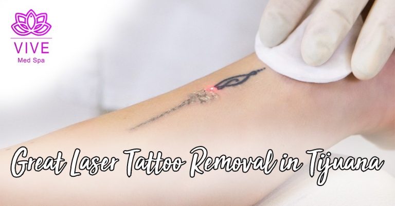 Read more about the article Take that tatoo off your skin!