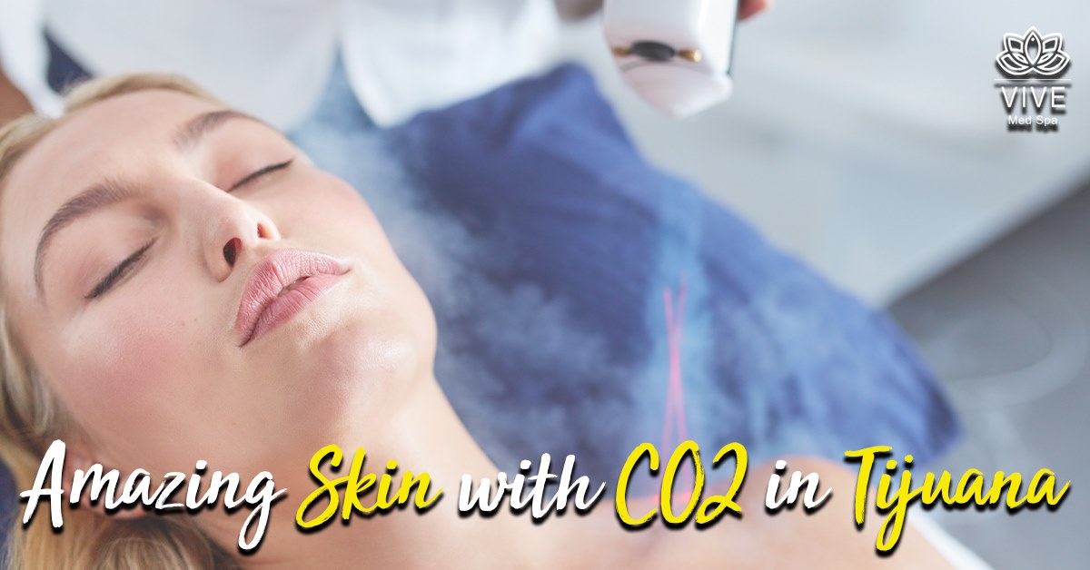 You are currently viewing Get a perfect skin with CO2 Laser