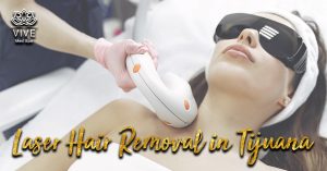 Read more about the article The best methods for hair removal in Tijuana