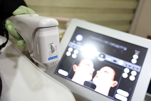 HIFU device and screen showing non-surgical face lift and skin tightening treatment plan at VIVE Medical Spa Tijuana