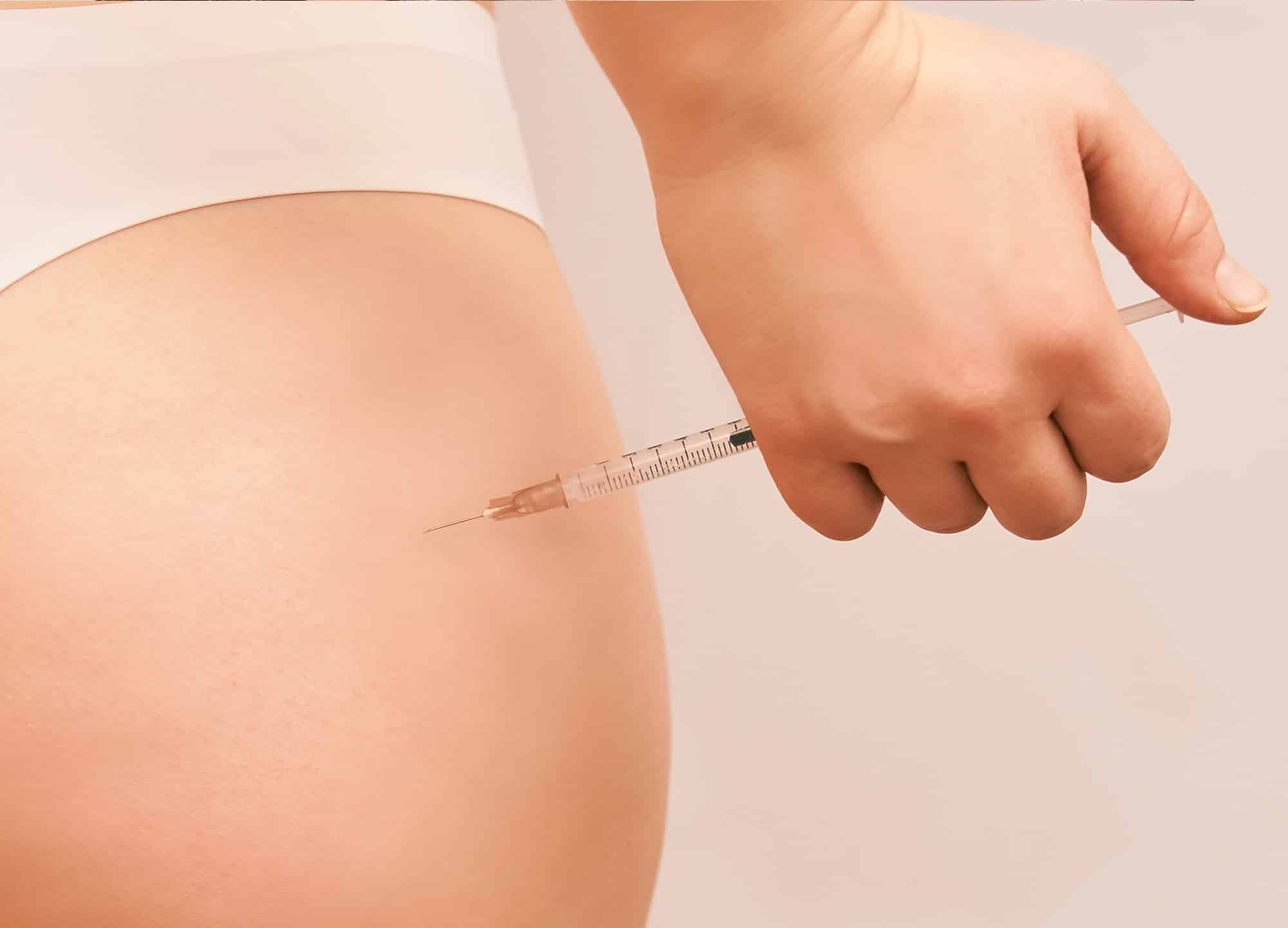 Butt filler injection in Tijuana for non-surgical gluteal enhancement