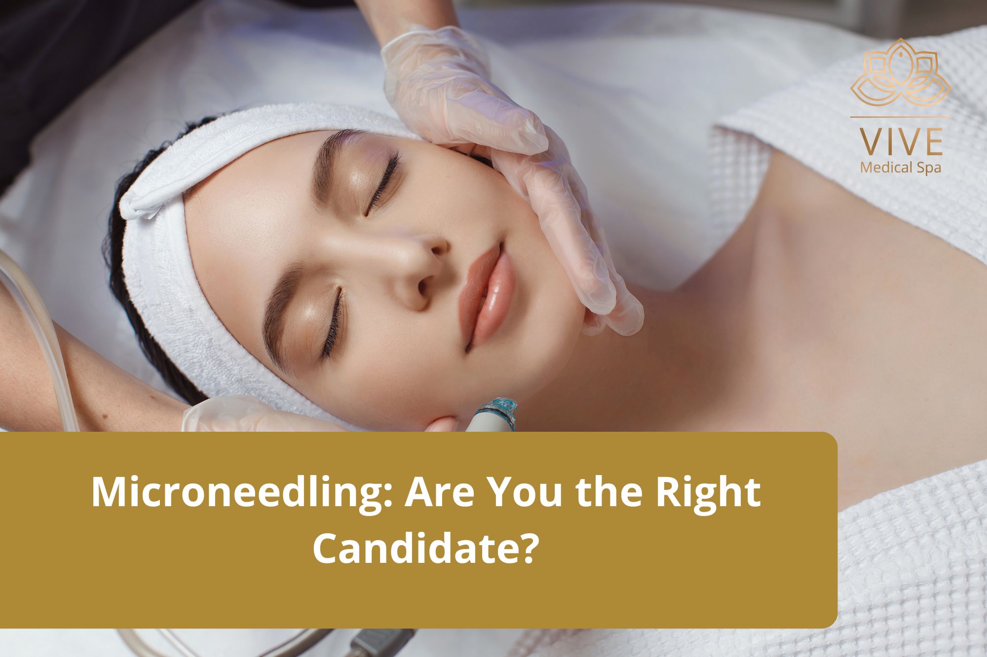 Microneedling Treatment - Are You the Right Candidate? | VIVE Medical Spa