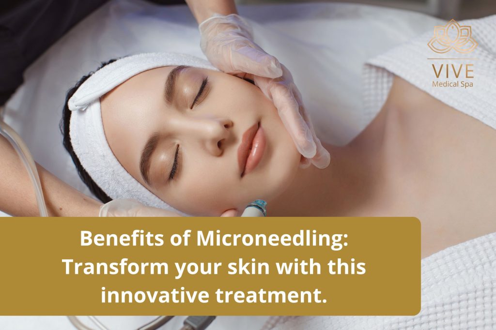 Microneedling Treatment at VIVE Medical Spa - Skin Rejuvenation for a Radiant Glow