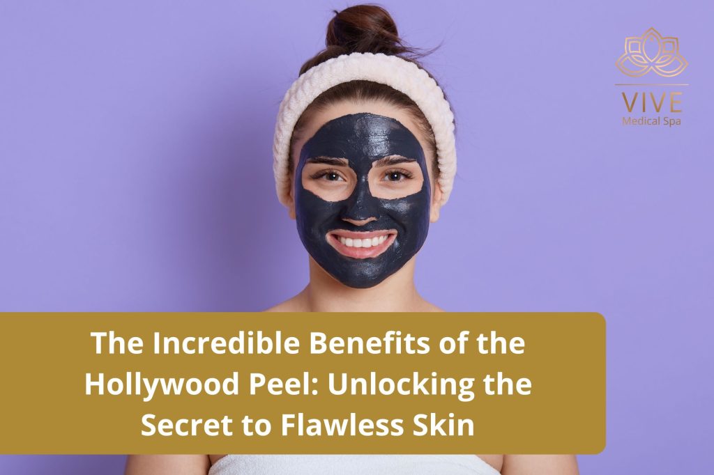Hollywood Peel at VIVE Medical Spa – Carbon Laser Facial for Flawless, Radiant Skin