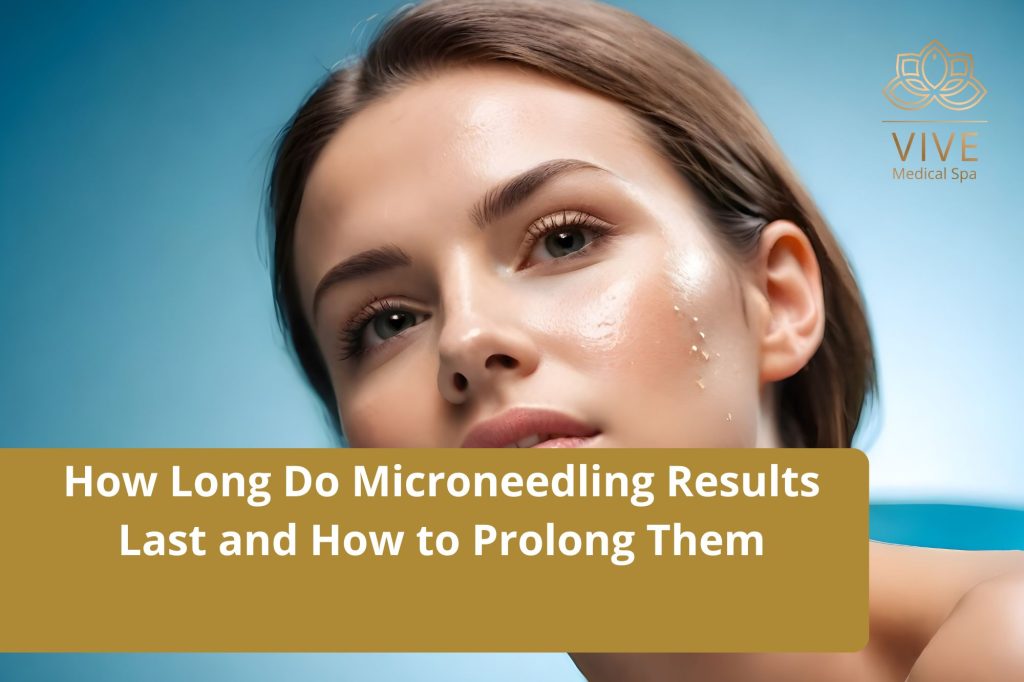 Microneedling Results Duration – How Long They Last & Ways to Prolong the Effects | VIVE Medical Spa