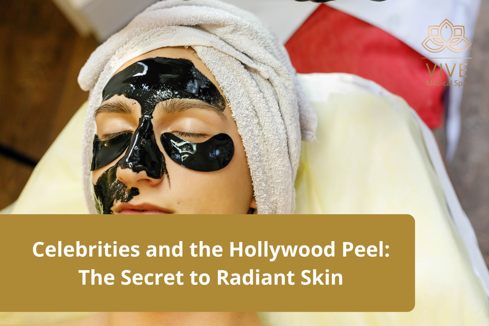 Hollywood Peel at VIVE Medical Spa – Celebrity skincare secret for glowing and youthful skin in Tijuana.