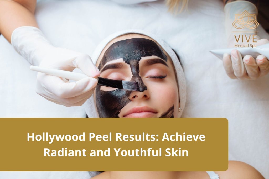 Hollywood Peel at VIVE Medical Spa – Achieve radiant, youthful skin with this advanced facial treatment in Tijuana.