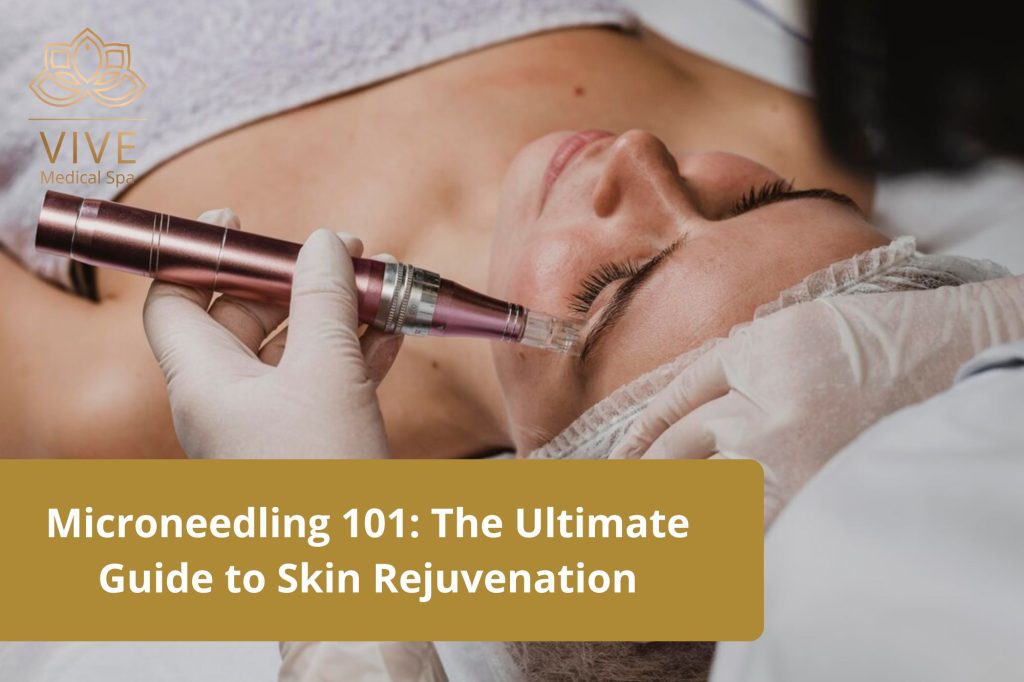 Woman receiving a microneedling treatment for skin rejuvenation at VIVE Medical Spa in Tijuana.