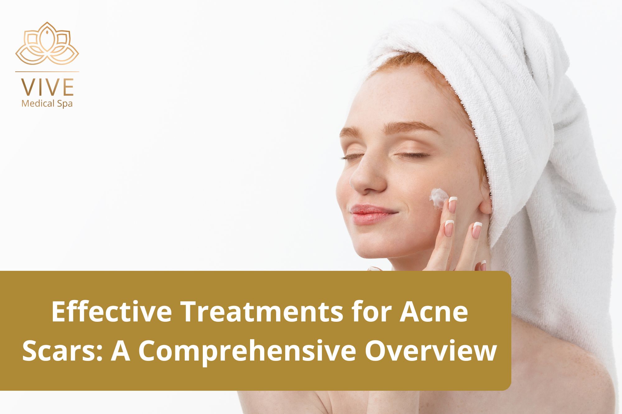 Woman applying skincare cream after acne scar treatment at VIVE Medical Spa in Tijuana.