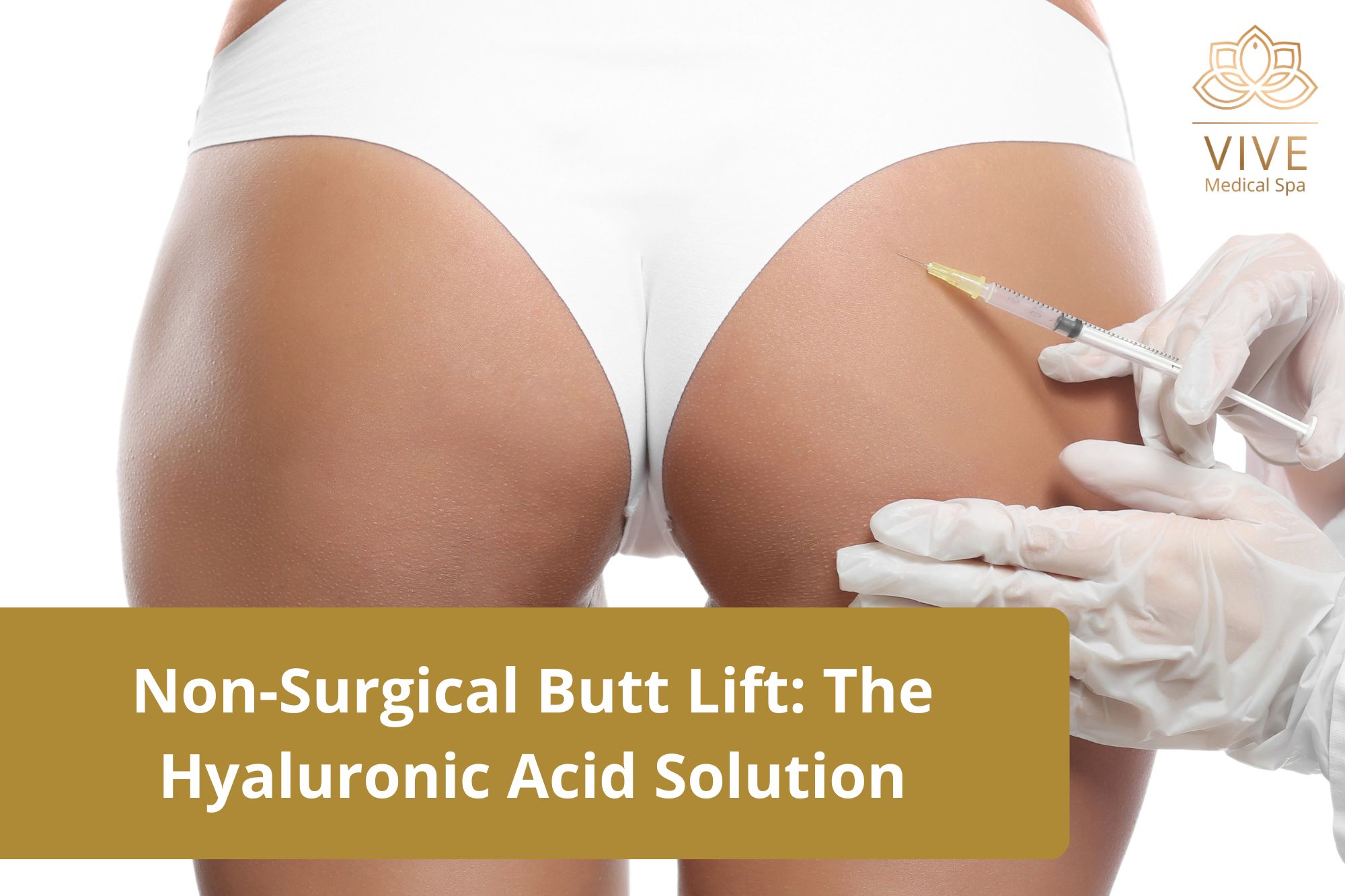 Non-surgical butt lift in Tijuana – Hyaluronic acid butt fillers at Vive Medical Spa for volume, shape, and lift without surgery.