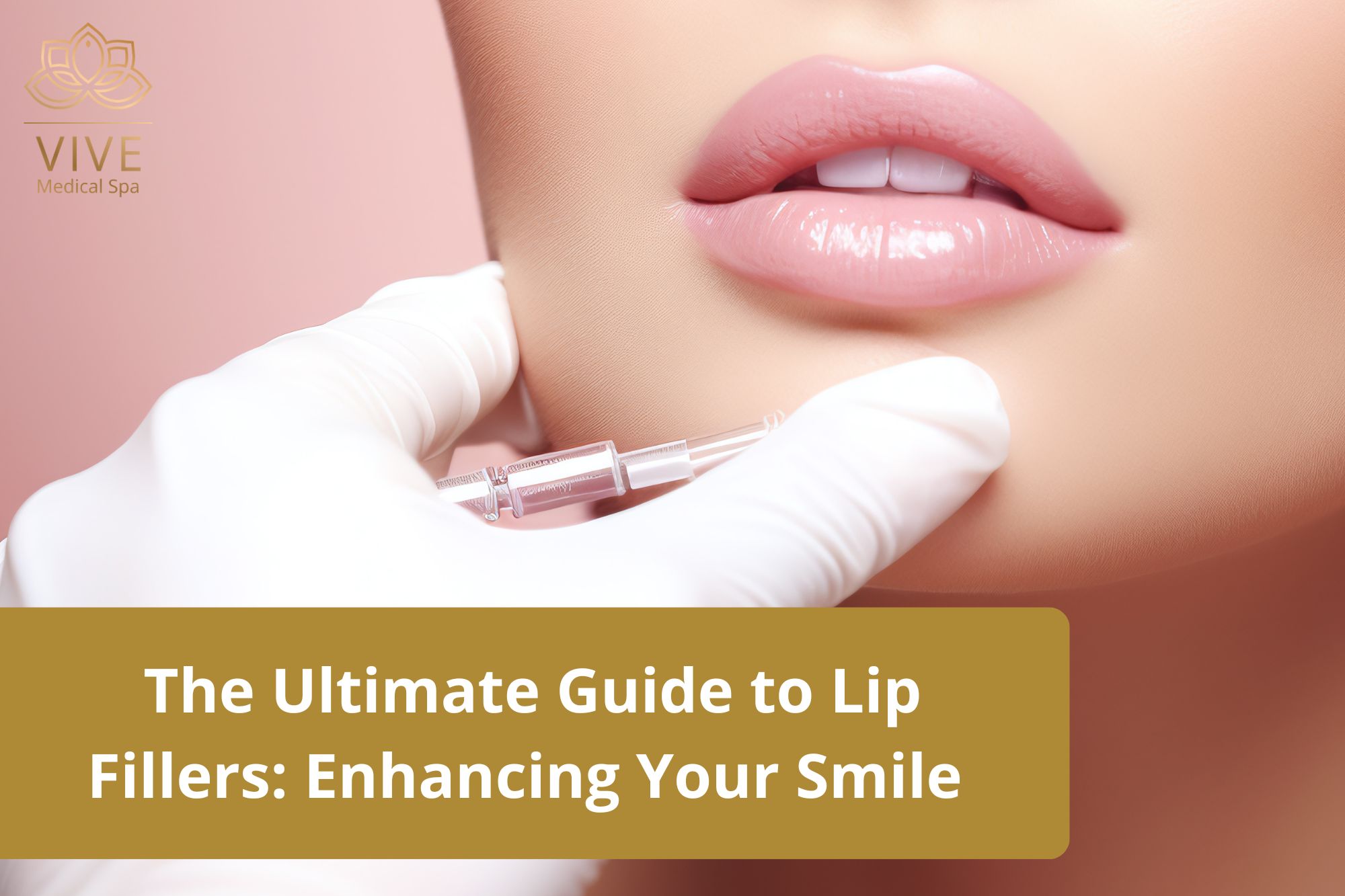 Lip fillers in Tijuana – Professional lip enhancement with dermal fillers at Vive Medical Spa for a natural and voluminous look.