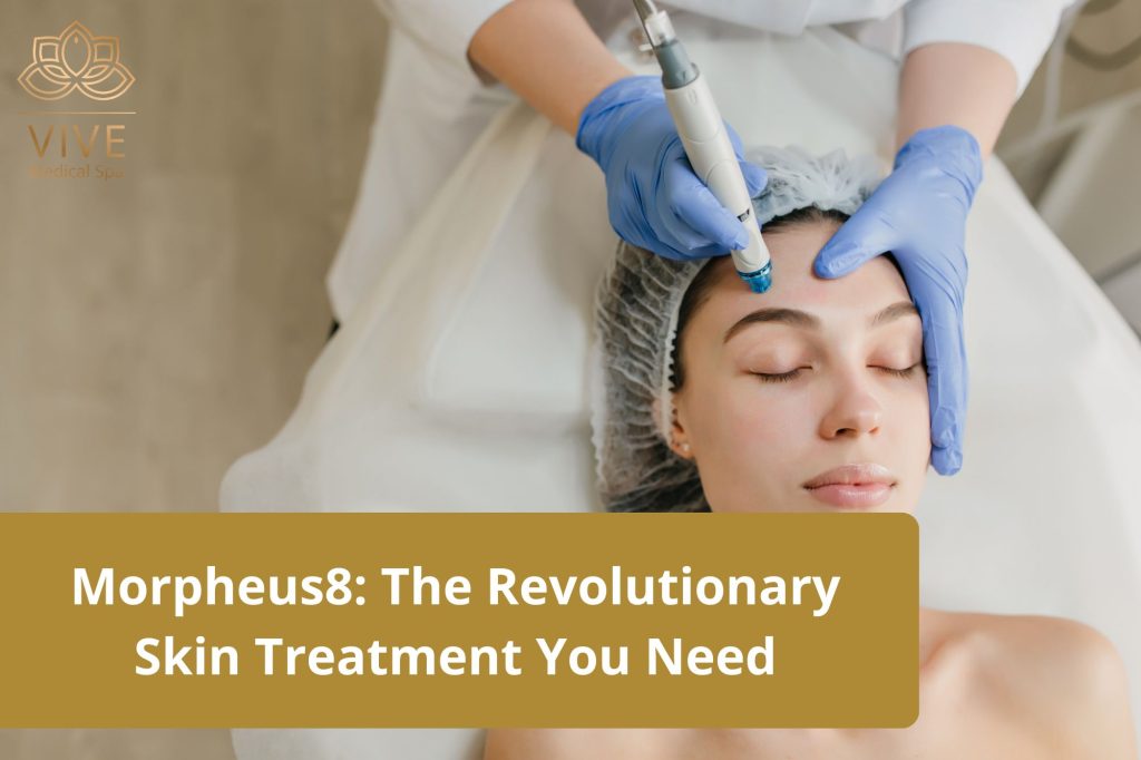 Morpheus8 in Tijuana – RF microneedling skin treatment at Vive Medical Spa for skin tightening, lifting, and rejuvenation.