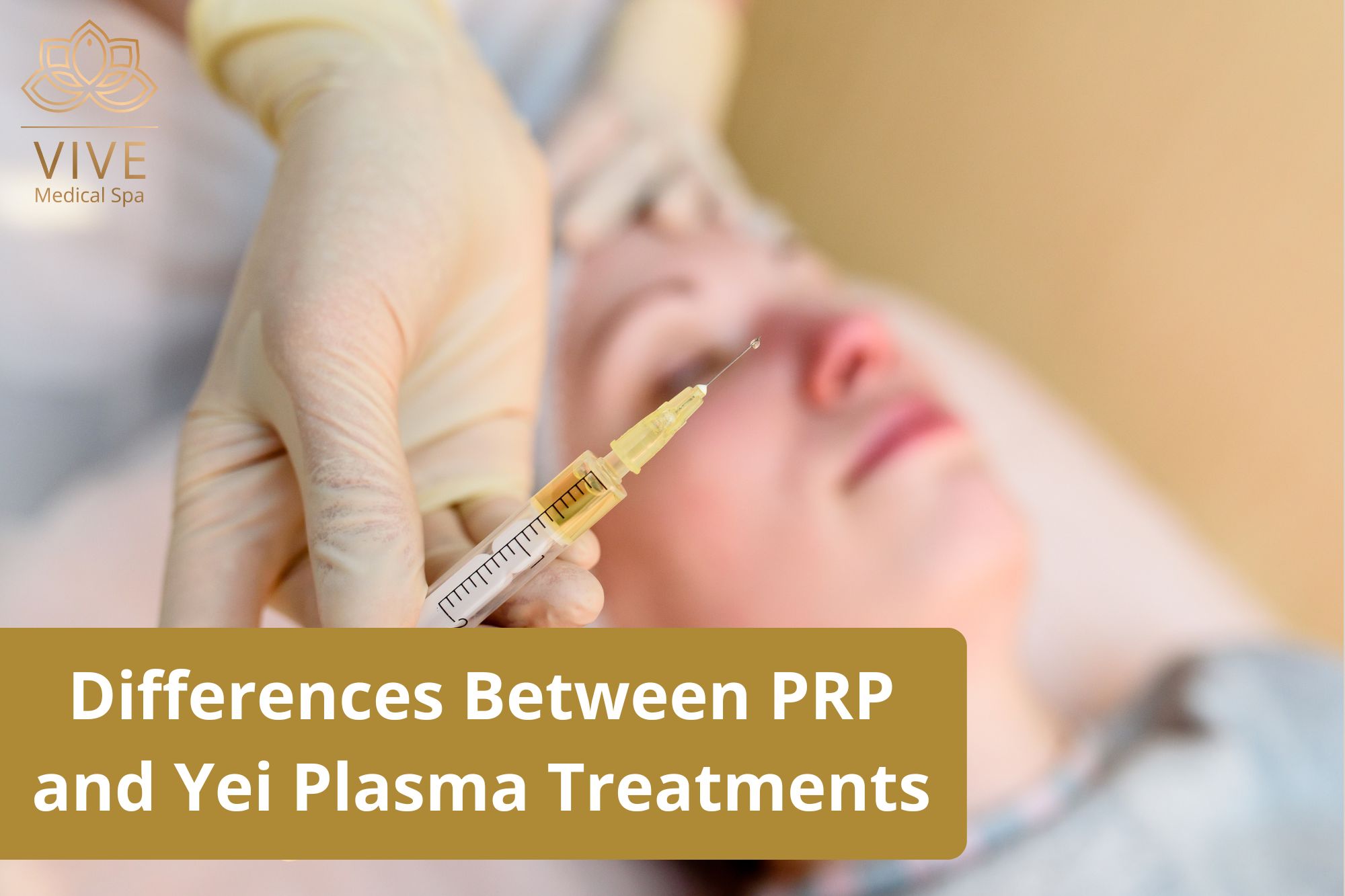 PRP Therapy vs. Yei Plasma in Tijuana – Non-surgical skin and hair rejuvenation at Vive Medical Spa.