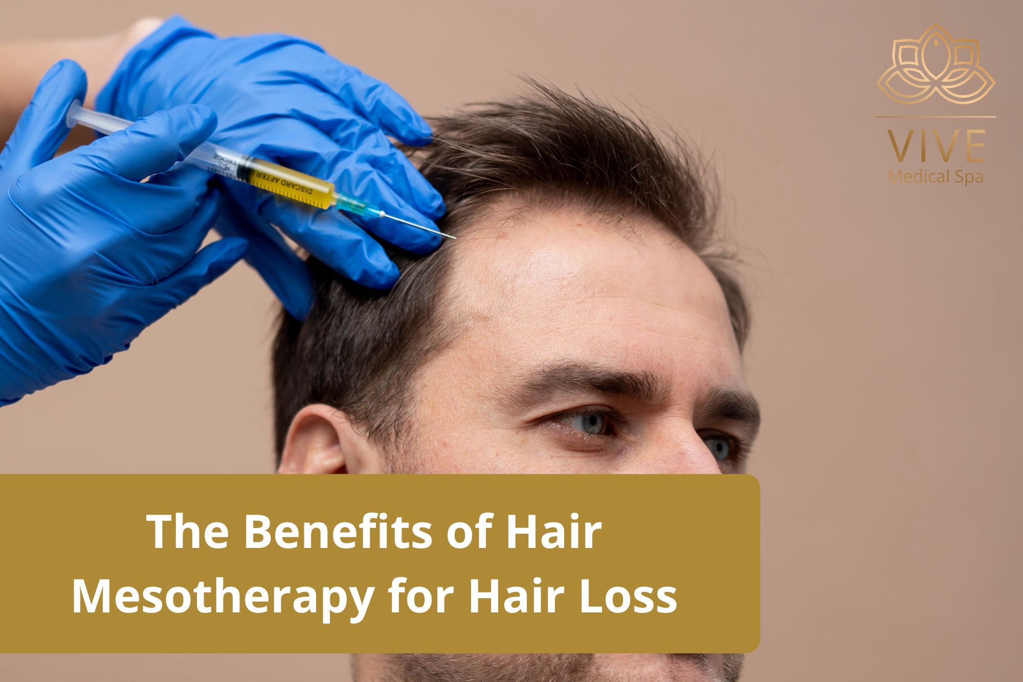 Man receiving hair mesotherapy treatment for hair loss at VIVE Medical Spa