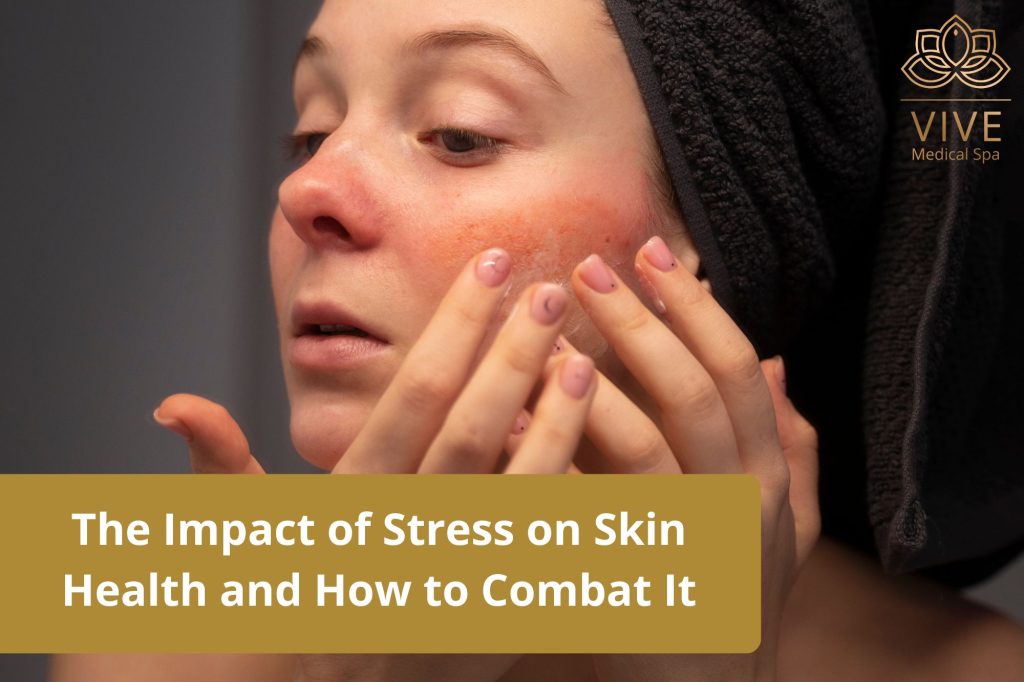 Woman examining her skin affected by stress, highlighting the impact of stress on skin health and solutions offered by Vive Medical Spa.