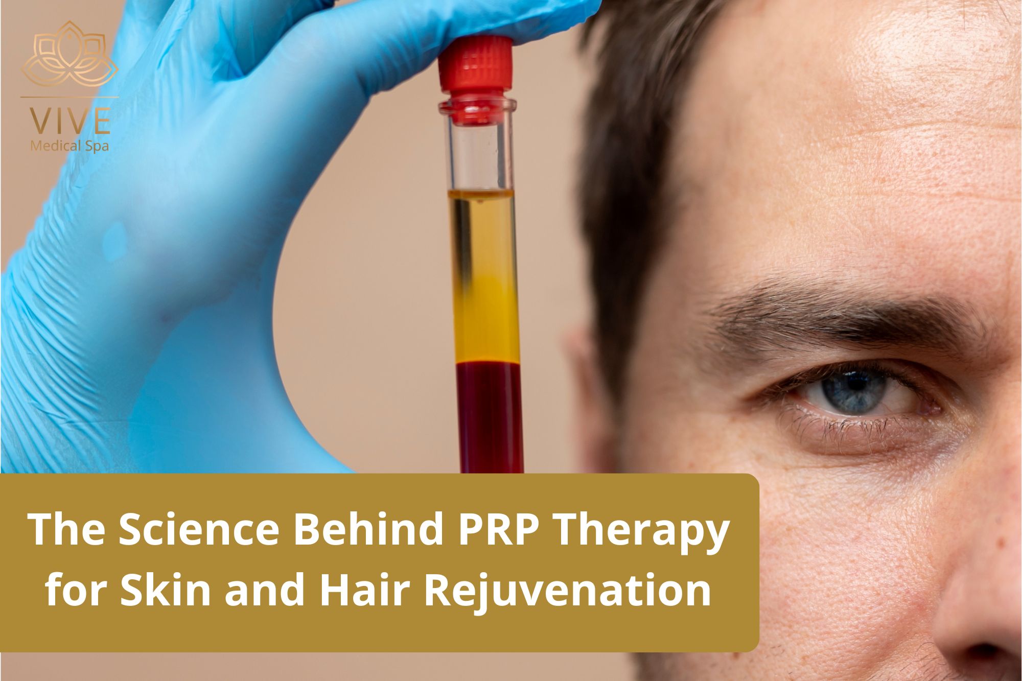 PRP therapy with platelet-rich plasma for skin rejuvenation and hair growth at VIVE Medical Spa