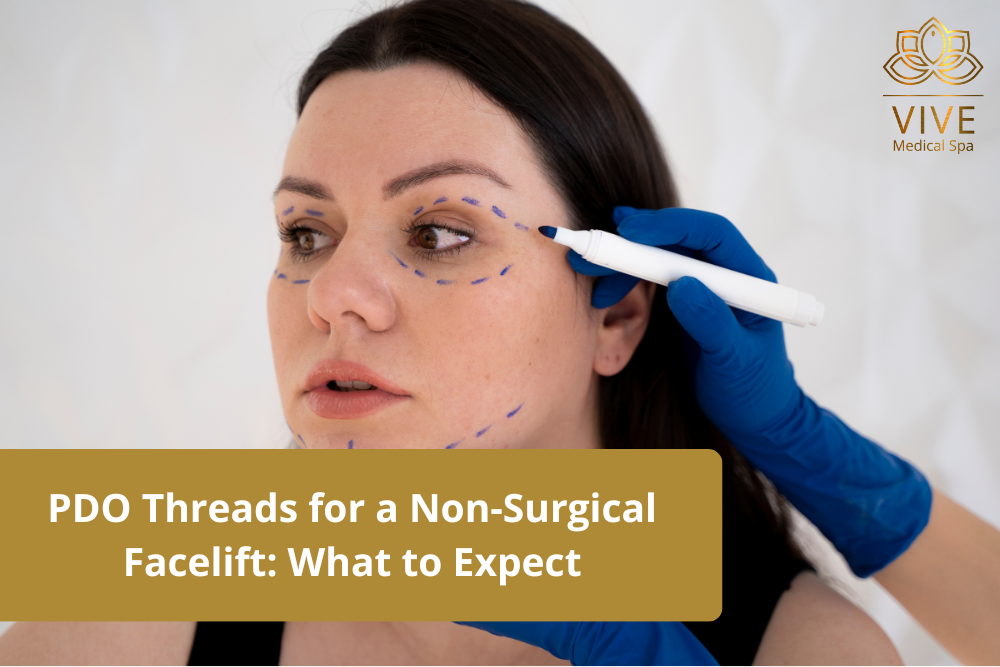 Woman undergoing PDO threads preparation for a non-surgical facelift at Vive Medical Spa, leaders in advanced rejuvenation treatments in Tijuana.