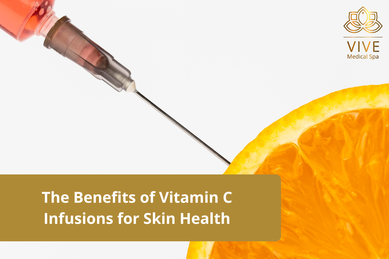 Vitamin C infusion treatment for glowing and healthy skin at Vive Medical Spa, Tijuana.