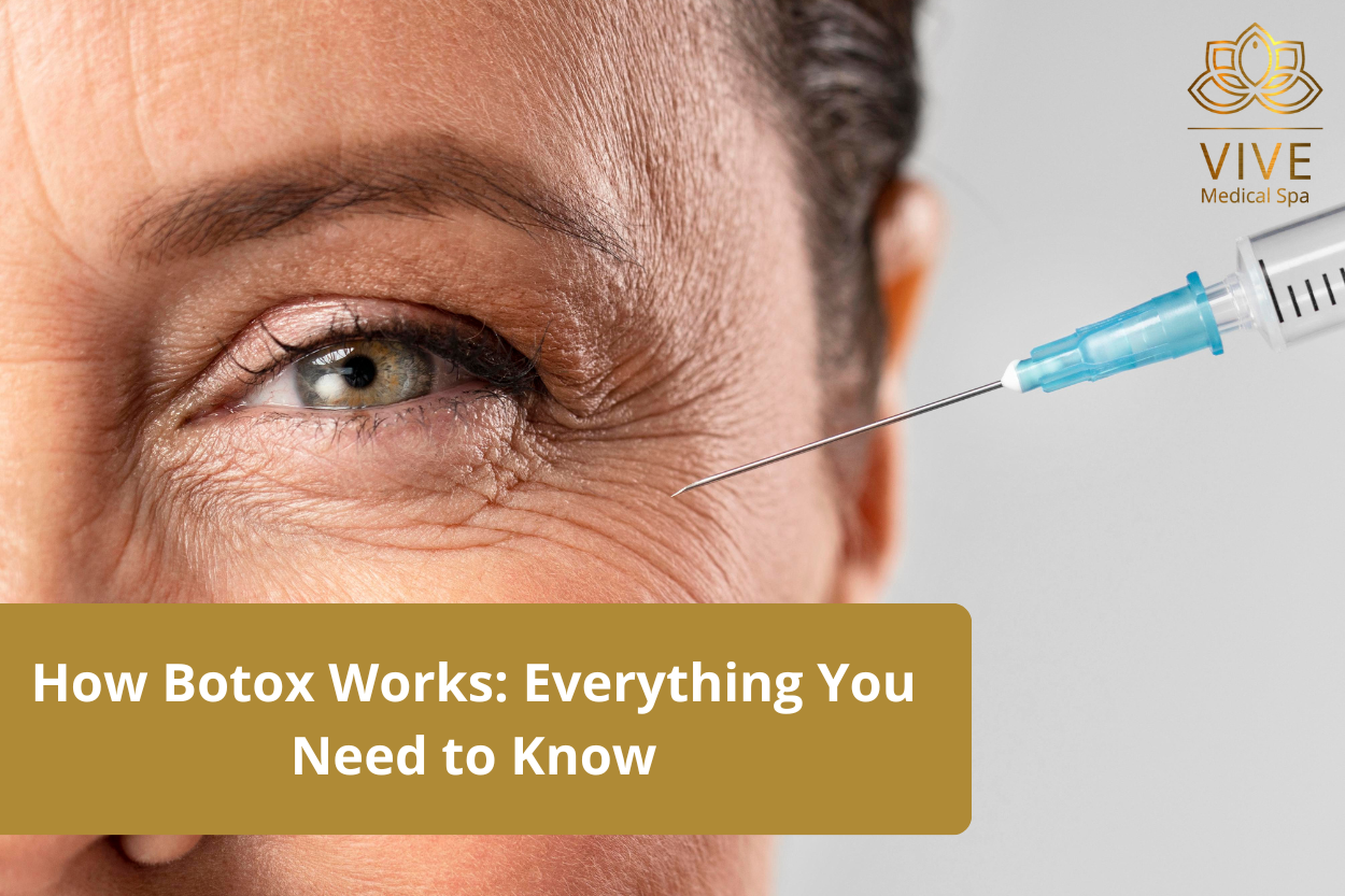 Close-up of Botox injection for reducing eye wrinkles at Vive Medical Spa, Tijuana.