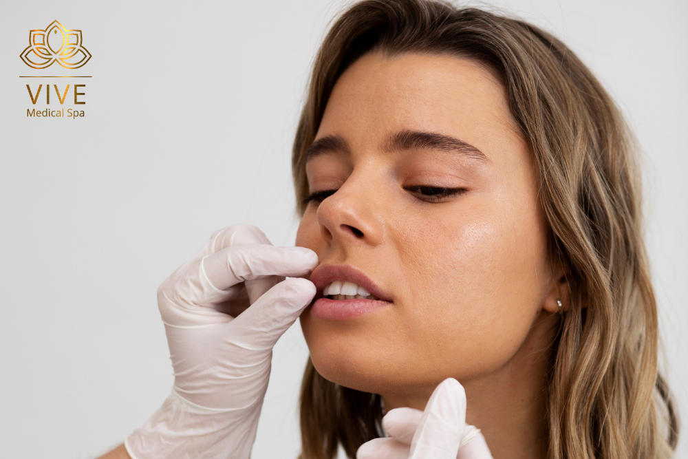 Image showcasing a woman undergoing a professional lip filler procedure at Vive Medical Spa.