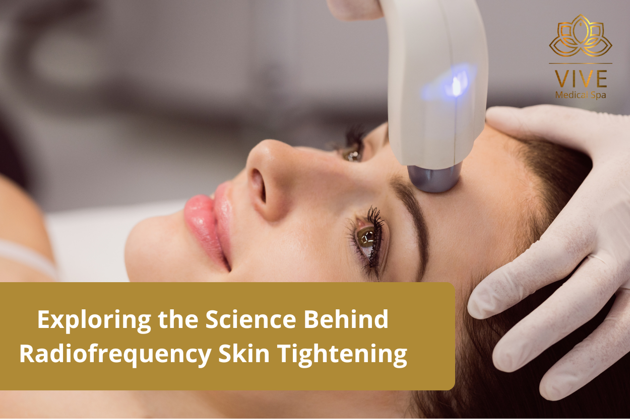 Woman undergoing radiofrequency skin tightening treatment at Vive Medical Spa, Tijuana.