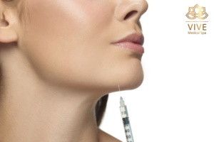 Stock image of chin filler injection procedure at VIVE Medical Spa Tijuana