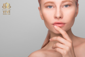 Stock image of woman with natural lips considering lip augmentation at VIVE Medical Spa Tijuana