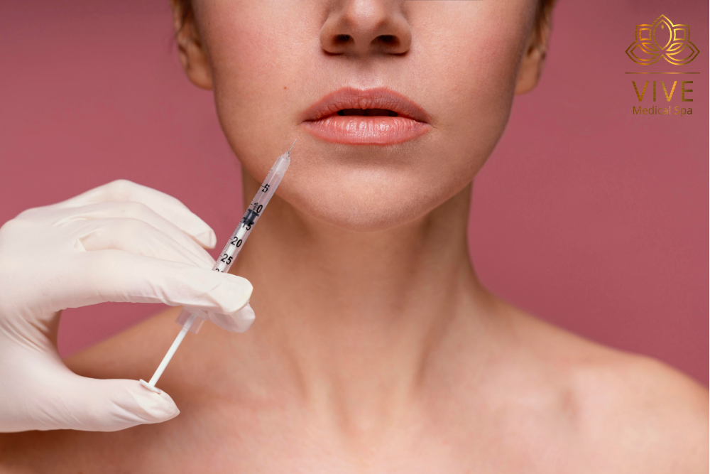 Stock image of chin filler injection procedure at VIVE Medical Spa Tijuana