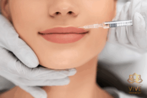 Lip filler injection for natural lip enhancement at VIVE Medical Spa Tijuana